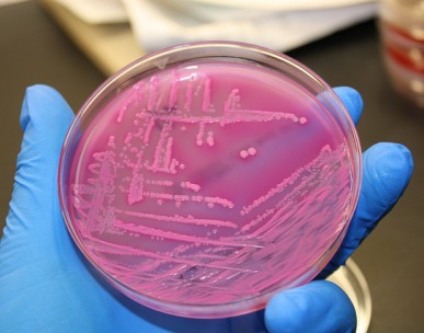 Evolution of E. coli revealed