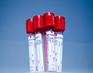 New prostate cancer test method