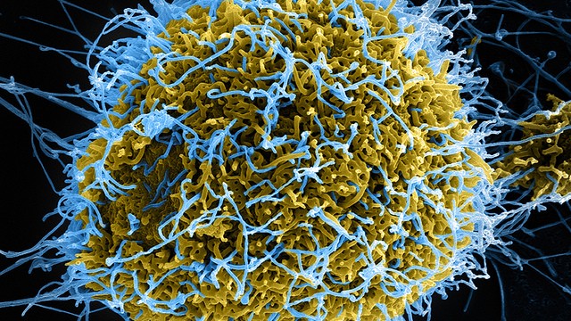 IMI to invest €200m in Ebola research, say reports
