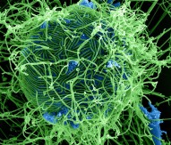 Johnson & Johnson develops consortia to tackle Ebola