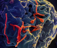 EU announces research results to tackle Ebola disease