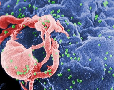 AIDS vaccine candidate successfully ‘primes’ immune system