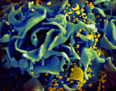 HIV-infected T cell