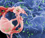 Scanning electron micrograph of HIV-1, coloured green