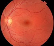 Human eye retina