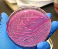 Evolution of E. coli revealed