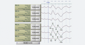 alpha trace medical systems